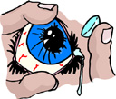 Ношение контактных линз может привести к слепоте